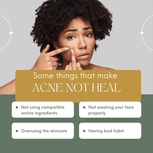 Acne not healing 